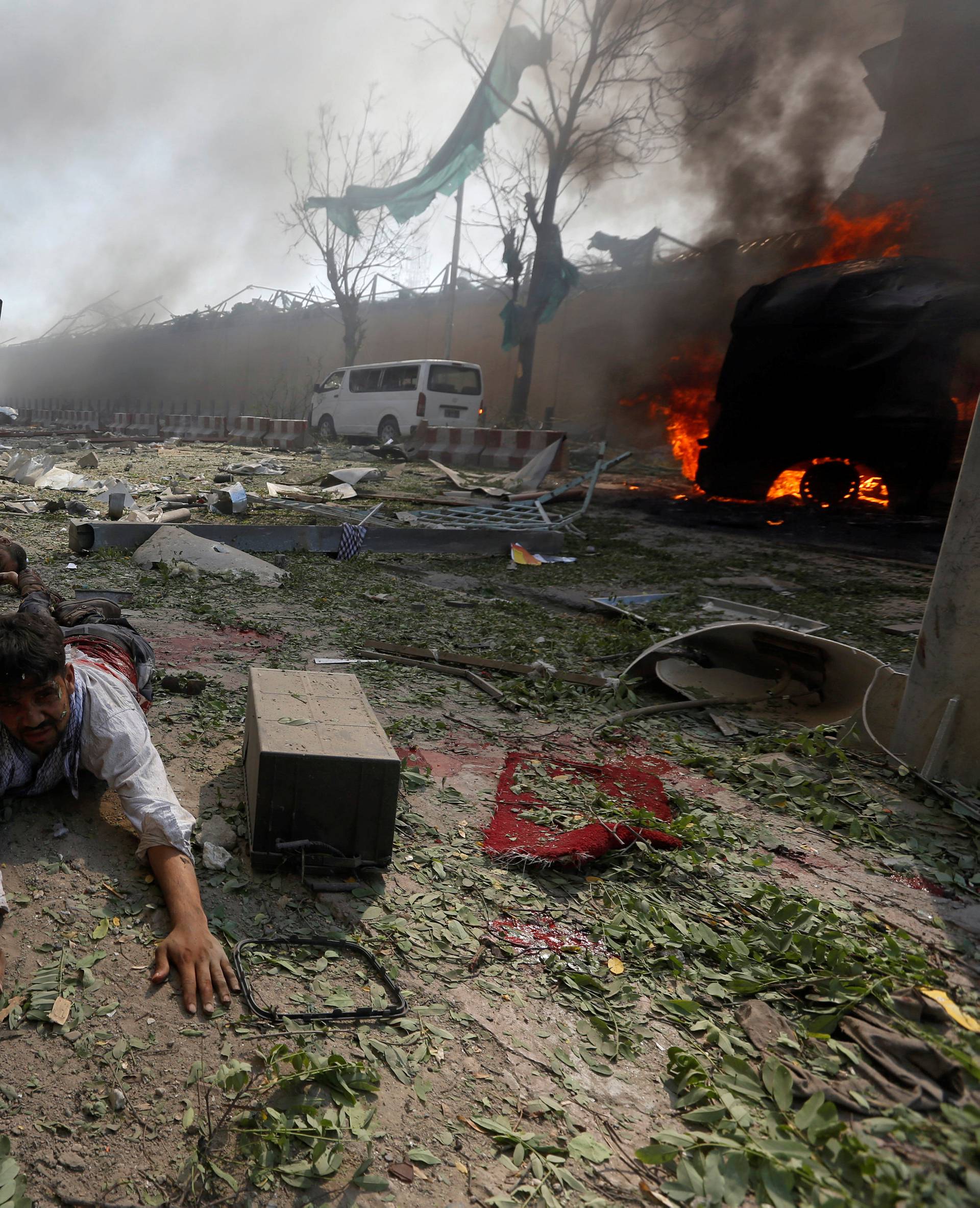 A wounded man lies on the ground at the site of a blast in Kabul, Afghanistan