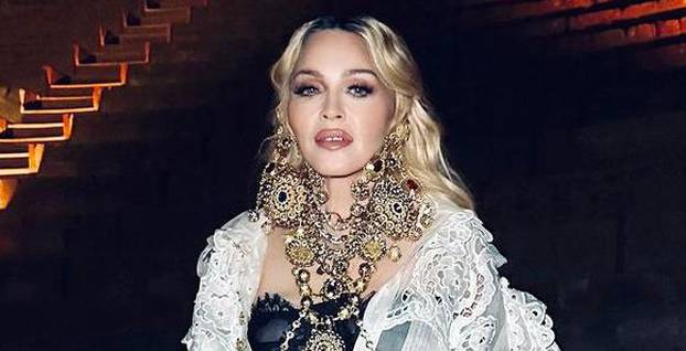 FOTO Zbog operacija postali neprepoznatljivi: Neke zvijezde su 'pod nož' išle čak 300 puta