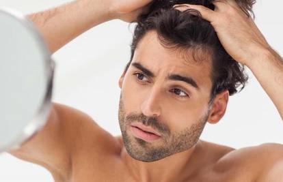 Učinkovito riješite problem prorijeđene kose uz Nanogen