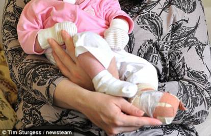 Medicinske sestre spalile bebi cijelo stopalo kipućom vodom