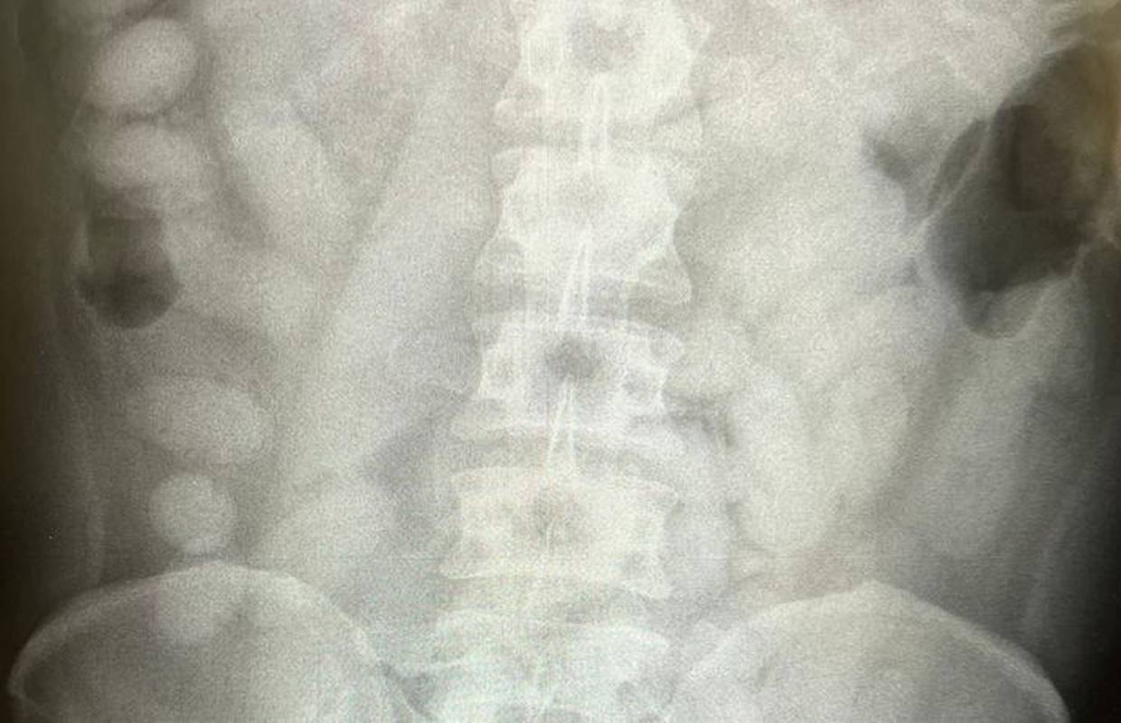Uhvaćena mula u Njemačkoj s kilogram kokaina u trbuhu: Putovao je prema Hrvatskoj