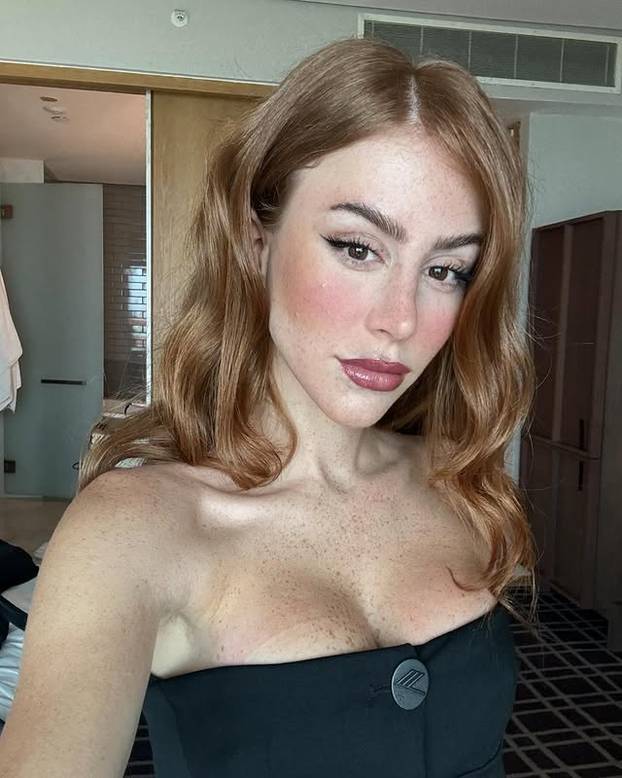 FOTO Posebna ljepota: Milijuni ljudi obožavaju njezine pjegice