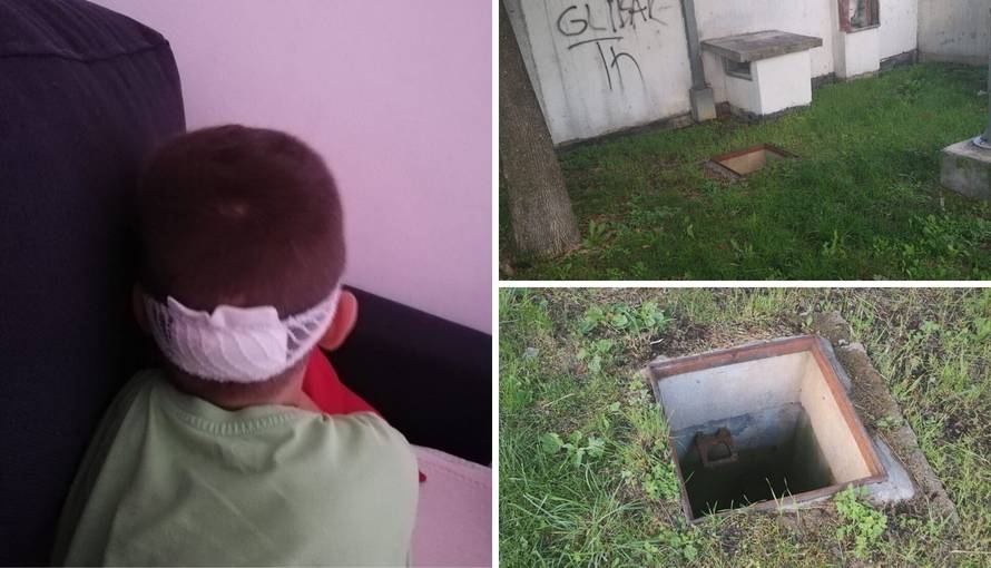 Dječak upao u šaht, majka u šoku: Ima hematome i šavove, očekujem reakciju nadležnih
