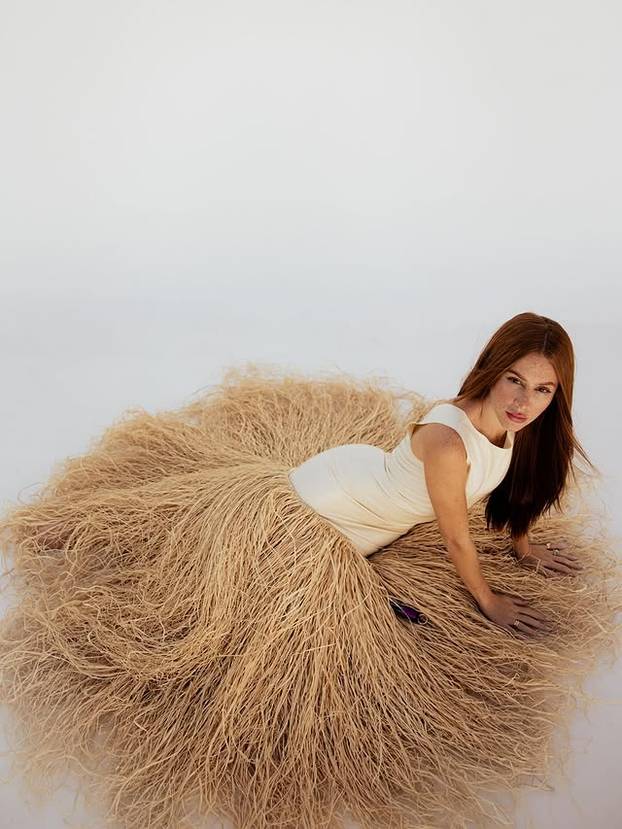 FOTO Posebna ljepota: Milijuni ljudi obožavaju njezine pjegice