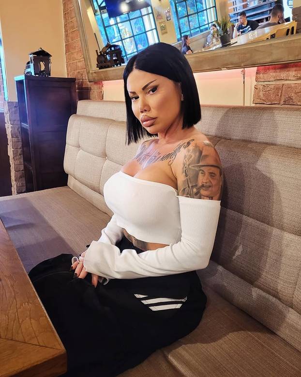 FOTO Sudionici reality showa na dvorištu pukao silikon stražnjice