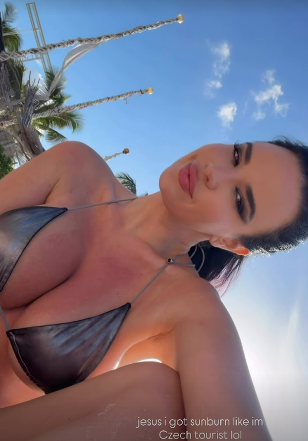 FOTO Je li ovo uopće bikini ili samo par špagica? Evo u što se uvukla Knollica: 'Izgorjela sam'