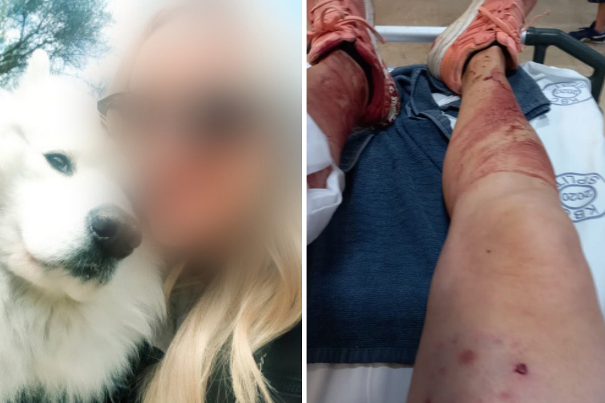 Strava kraj Splita: Vučjak izletio iz dvorišta i izgrizao ženu, psu smrskao čeljust, na operaciji je