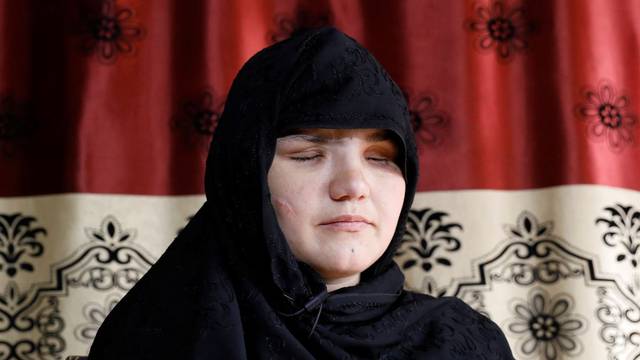 'Talibani su me mučili. Iskopali su mi oči. Ja sam se izvukla, ali bojim se za ove koje su ostale'