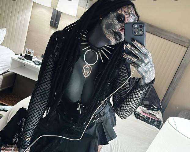 FOTO Uznemirujuće! Uklonila je čak i vrh nosa, a evo kako je izgledala: Šteta, ljepotica si bila