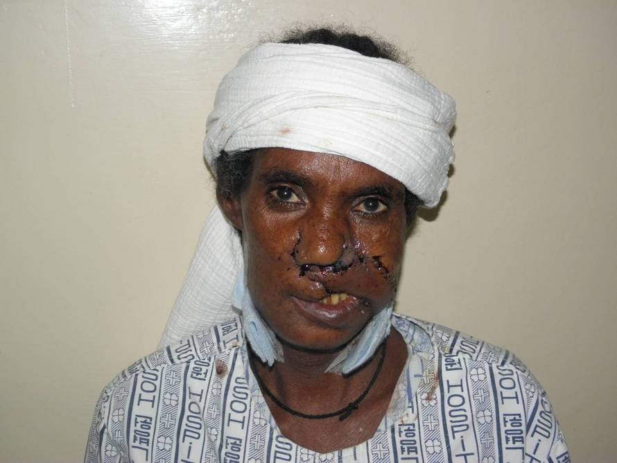 Liječnica velikog srca je otišla u Afriku operirati siromašne