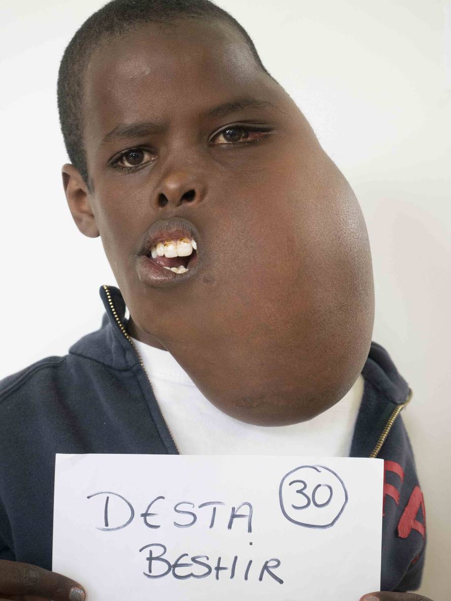 Liječnica velikog srca je otišla u Afriku operirati siromašne