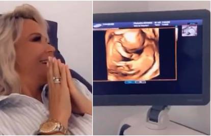 Maja pokazala ultrazvuk bebe: 'Što mislite je li cura ili dečko?'