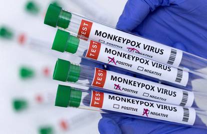 Europska komisija odobrila je cjepivo Bavarian Nordica za zaštitu od majmunskih boginja