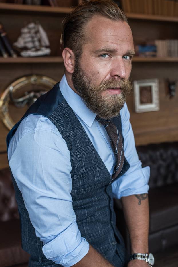 FOTO Zbogom, ćelavosti! Ovi su slavni muškarci presadili kosu