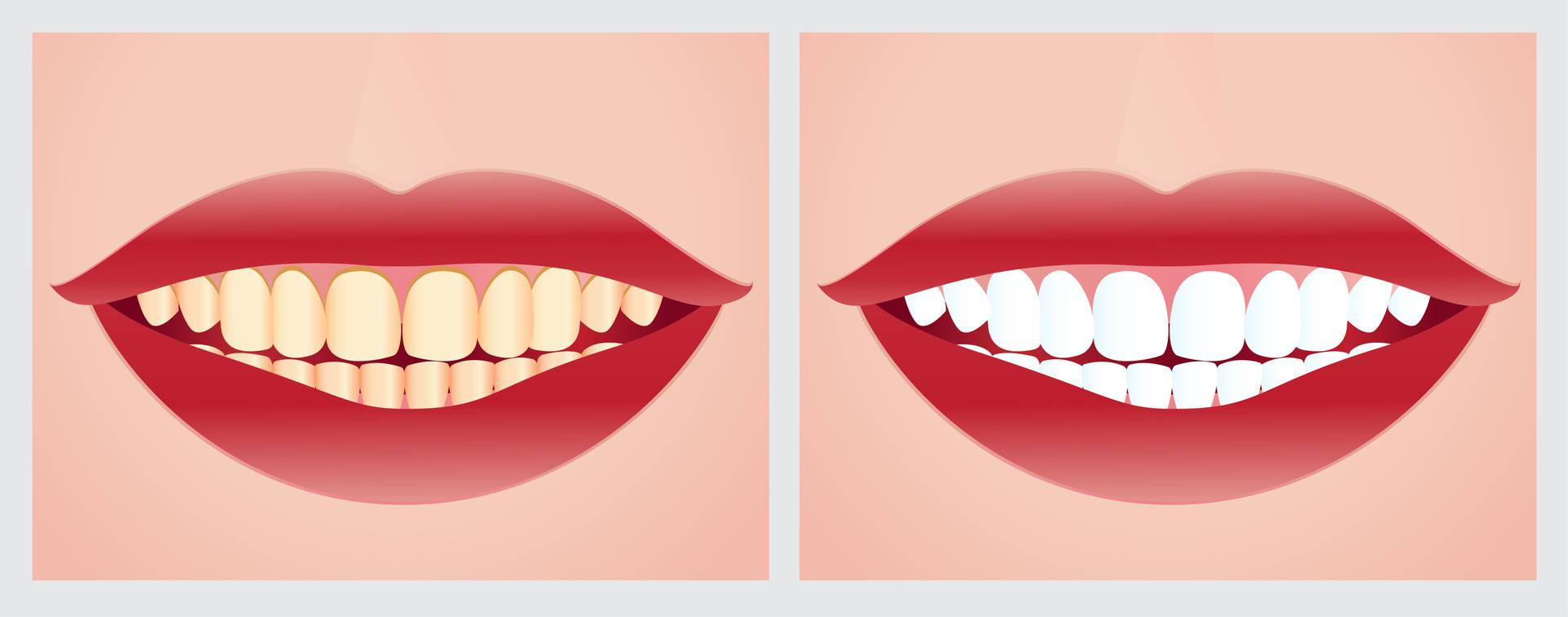 Šest je razloga zbog kojih zubi postaju žuti, evo kako si pomoći