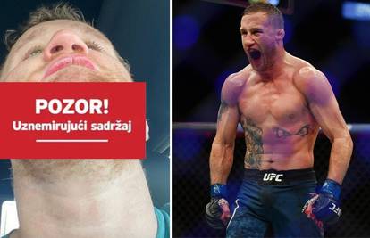 Rane s priprema za Khabiba: Gaethje išao na šivanje brade