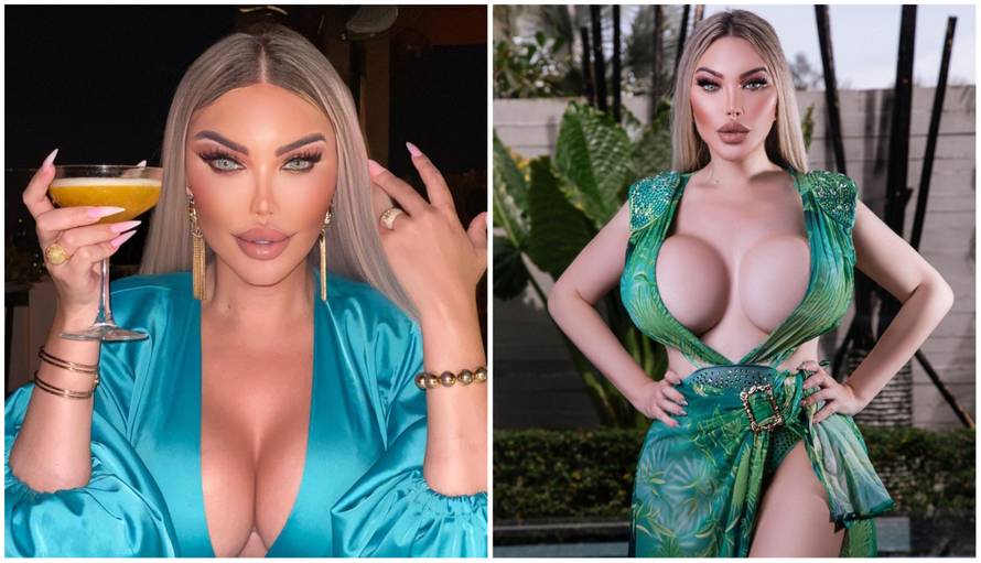 Bila je 'ljudski Ken', a operacije i dalje obožava: Nakon zadnjeg zatezanja lica ulovile je kamere