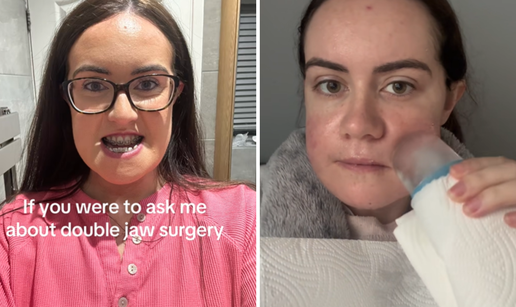 'Smijali su mi se i govorili da mi je čeljust ogromna, sada ću moći biti normalna djevojka'