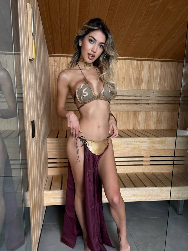 FOTO Sve joj je na mjestu! Prije su je ismijavali, danas zarađuje ogromne cifre kao model