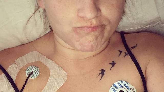 Žena zbog tampona završila u bolnici - uslijed toksičnog šoka