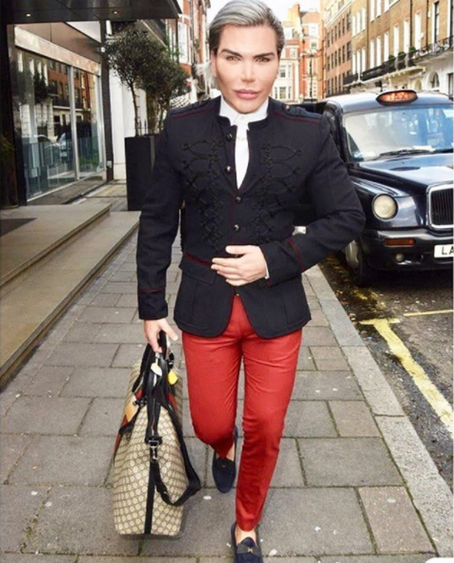 Ljudski Ken je prvi muškarac koji je izvadio čak četiri rebra