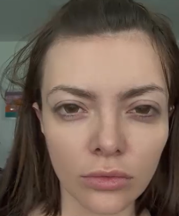 FOTO Ella Dvornik zatezala je kapke, a ni mami Danijeli nisu strane estetske operacije