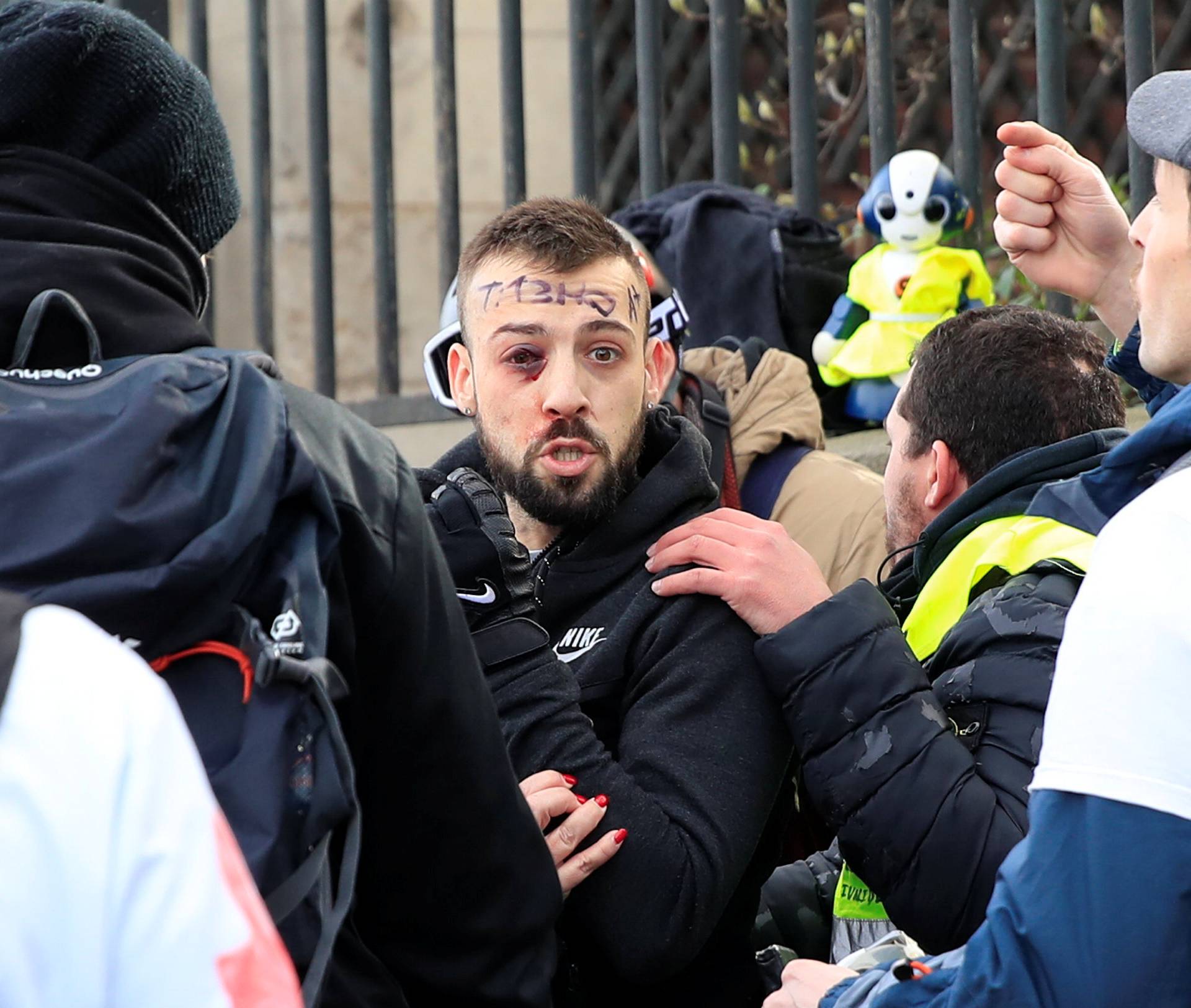 An injured protester is given help during a demonstration by the "yellow vests" movement in Paris