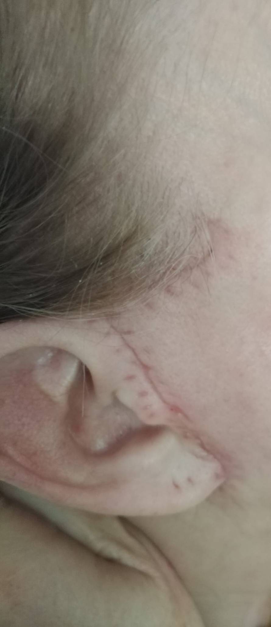 Estetski kirurg iz Zagreba htio ušutkati žene koje su se žalile na njega, stigla mu opomena!