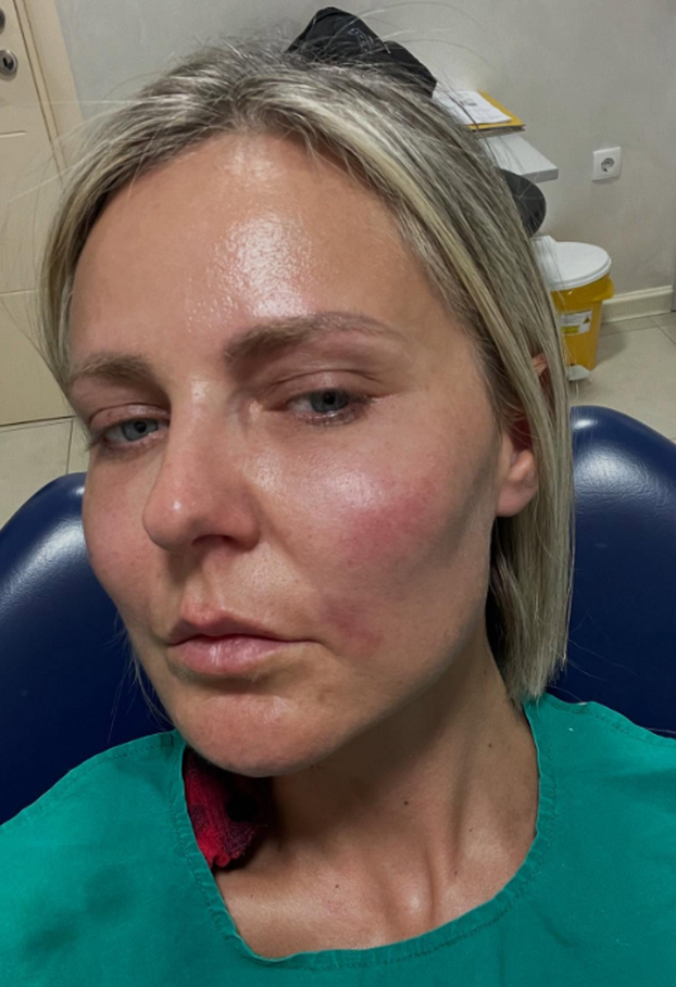 FOTO Ove slavne dame išle su pod nož: Neke su zablistale, drugima su zahvati uništili lice