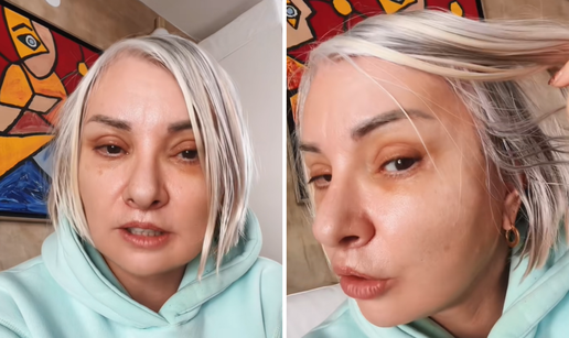 Danijela Dvornik pokazala kako izgleda 16 dana nakon operacije lica: 'Oči su još uvijek natečene'