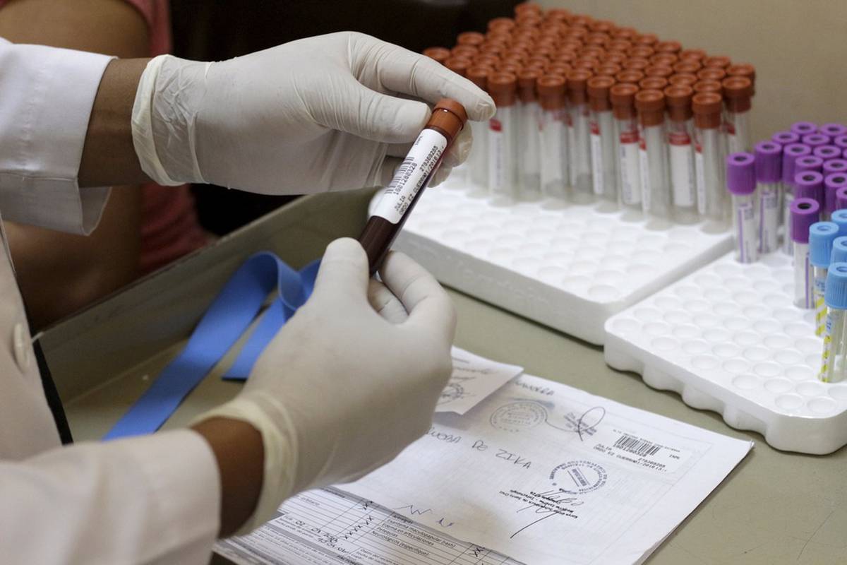 Nema opasnosti: Drugi slučaj zaraze virusom zika u Sloveniji