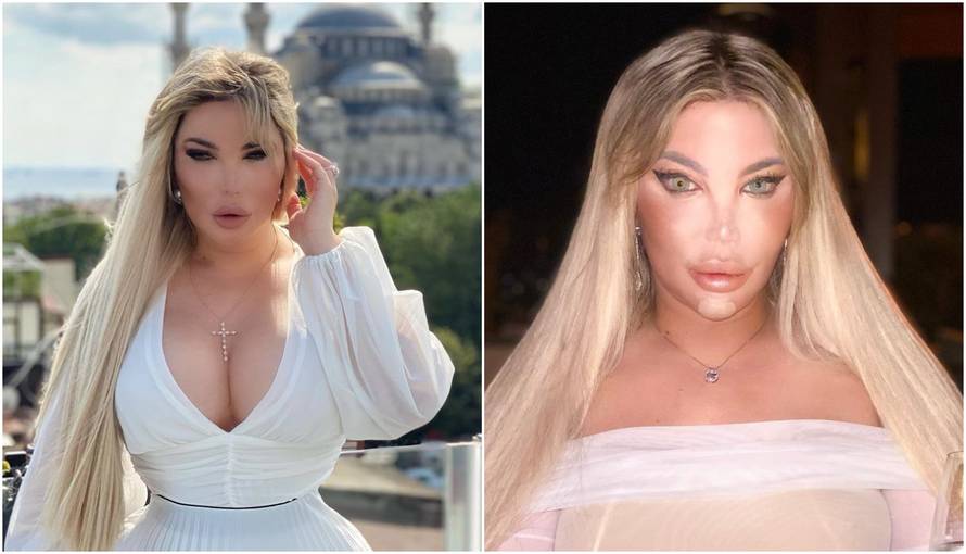 Bivši ljudski Ken na dijeti: Jede salatu i zabrinjava izgledom...