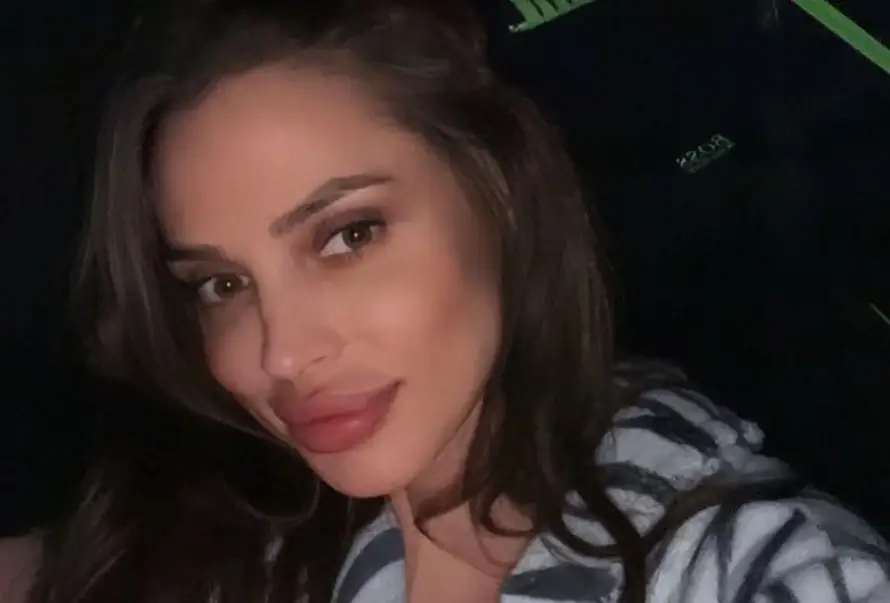 Srpskoj starleti slomljene kosti lica, objavila uznemirujuće slike iz bolnice: 'Pretukao me dečko'