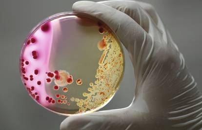 Antimikrobni lijekovi: Sve više superbakterija otporno na njih