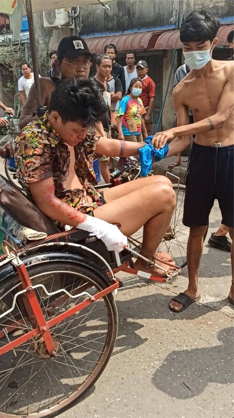 An injured civilian is transported on a rickshaw during protests against the military coup, in Hlaing township in Yangon