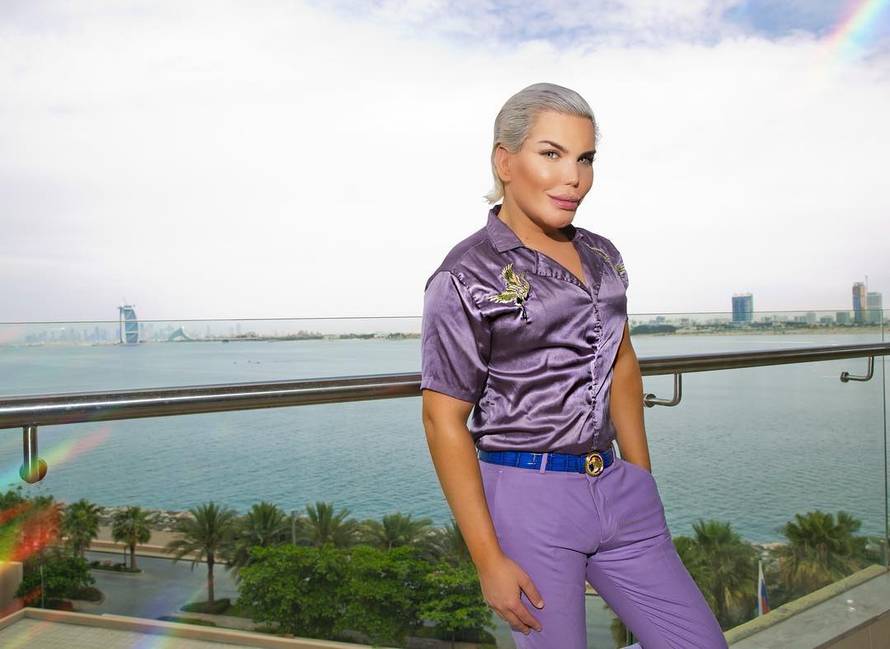 Ljudski Ken je postao Barbie: Ugradio izblajhane ekstenzije