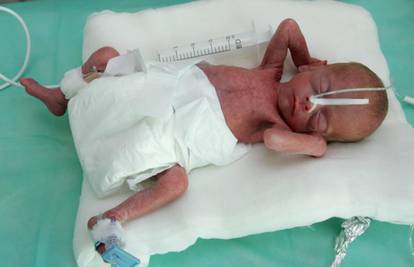 Beba heroj imala je 660 g, a bila je dugačka 31 cm