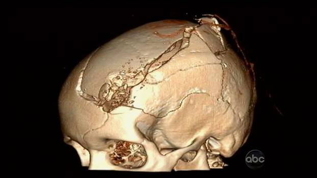 Congresswoman Gabby Giffords and her husband Mark Kelly share their story with ABC's Diane Sawyer in a 20/20 Special