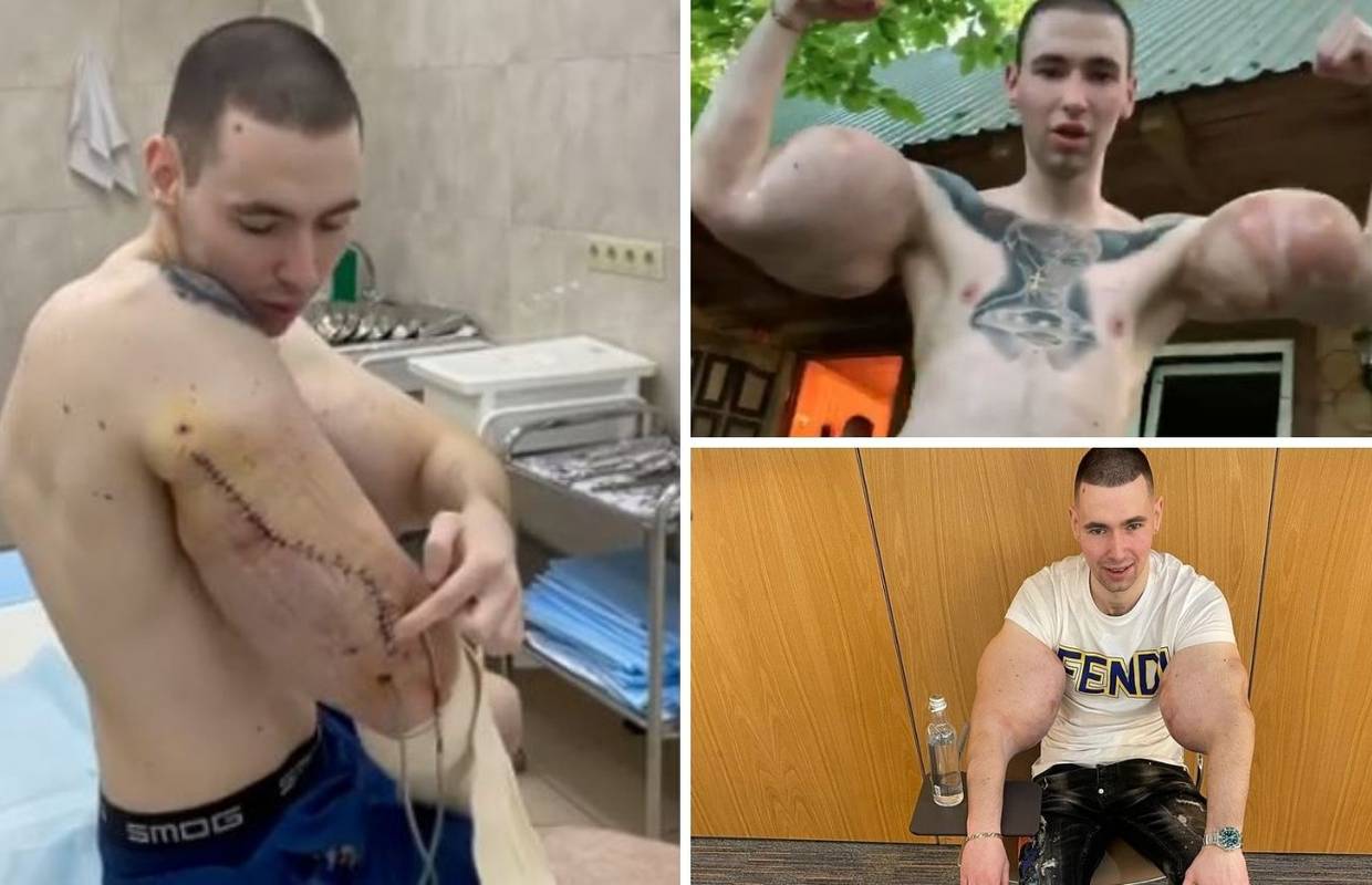 Ruski popaj bio je na operaciji: Hvala kirurgu, spasio mi je život
