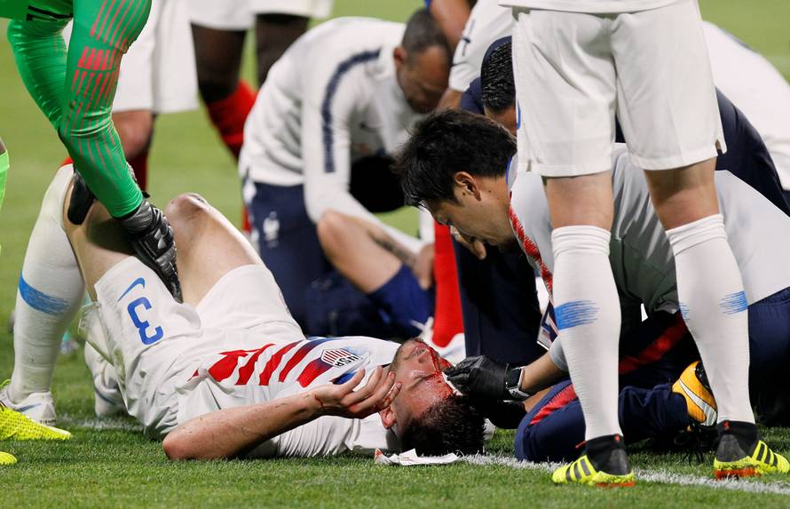 International Friendly - France vs USA