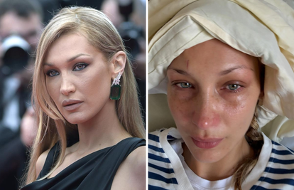 Bella Hadid zabrinula fanove fotkama iz bolničkog kreveta, bori se s teškom bolešću...