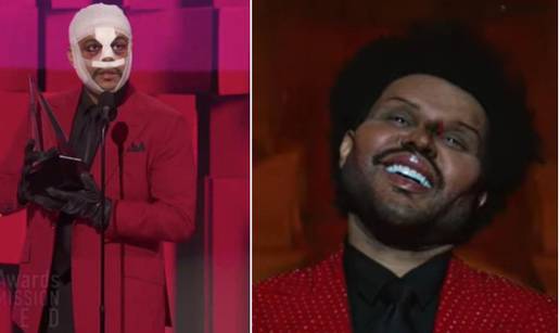 The Weeknd šokirao gledatelje transformacijom lica: 'Užas...'