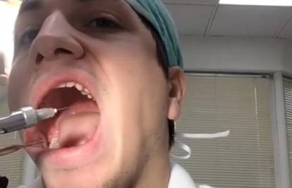 Sam svoj majstor: Zubar si je izvadio zub i snimio operaciju