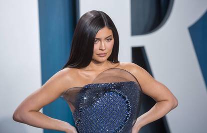 Je li Kylie Jenner pretjerala s estetskim tretmanima?