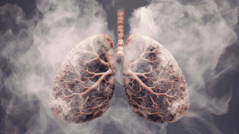 Simptomi i vrste raka pluća na koje morate obratiti pozornost
