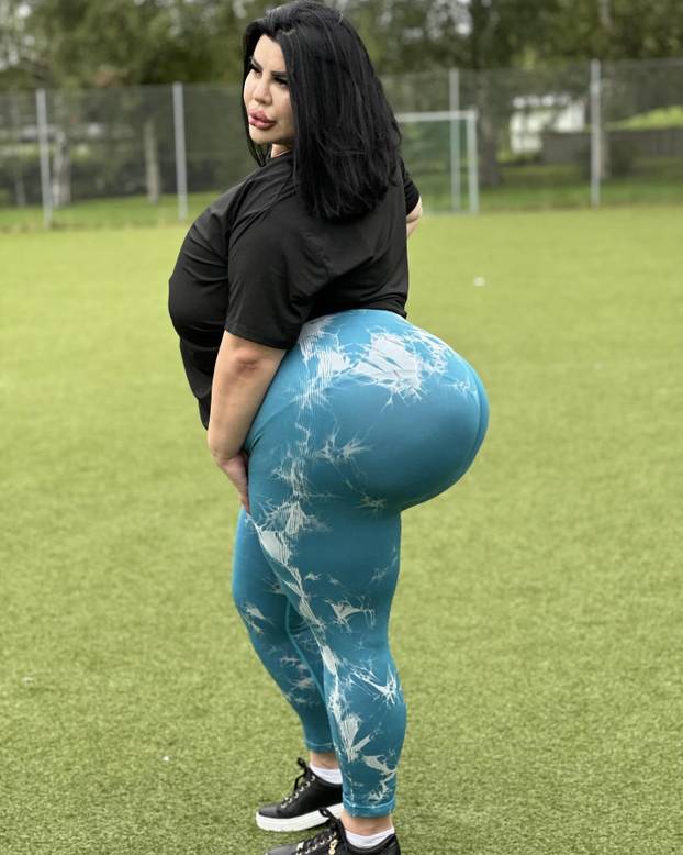 FOTO Stražnjica mi teži 45 kila, no već imam u planu sljedeću operaciju, želim imati najveću!