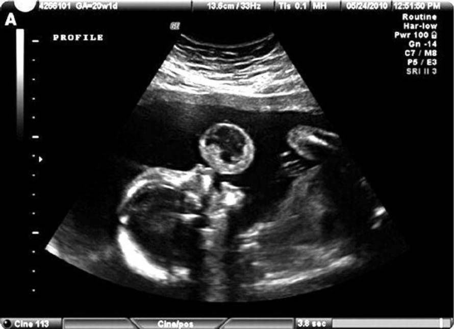 University of Mimami