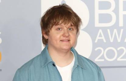 Lewis Capaldi otkazao nastupe nakon što je ostao bez glasa zbog Touretteovog sindroma