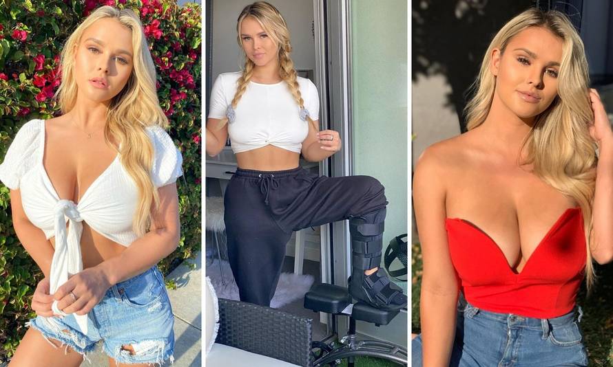 Kinsey slomila gležanj: 'Ali ću i dalje objavljivati fotke za vas...'