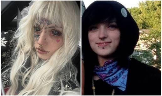 FOTO Djevojka riskirala sljepo&cacute;u zbog tetova&zcaron;e o&ccaron;nih jabu&ccaron;ica: Izgledam kao riba, ali ne &zcaron;alim